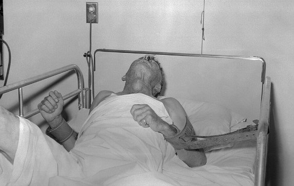 Patient atteint de la rage 1959
